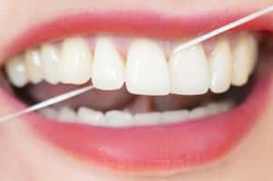 Are Your Gums Healthy?