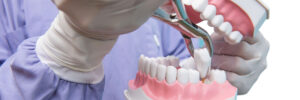 woodland hills tooth extraction